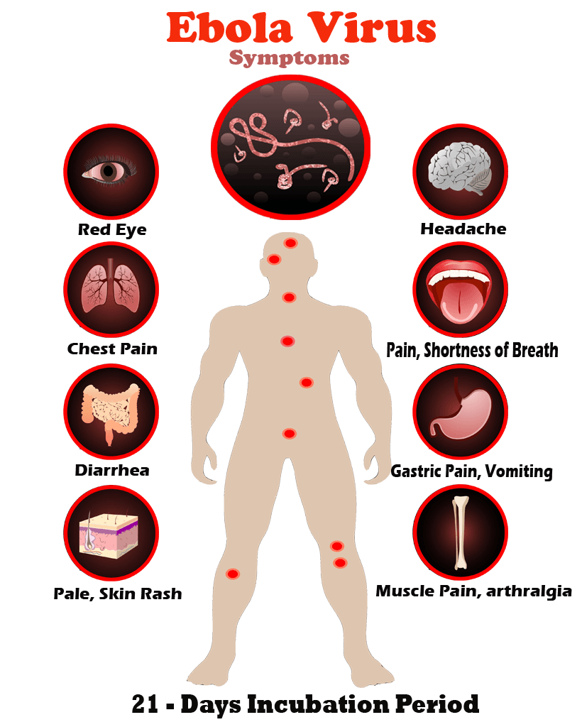 Ebola Virus - Infograpic
