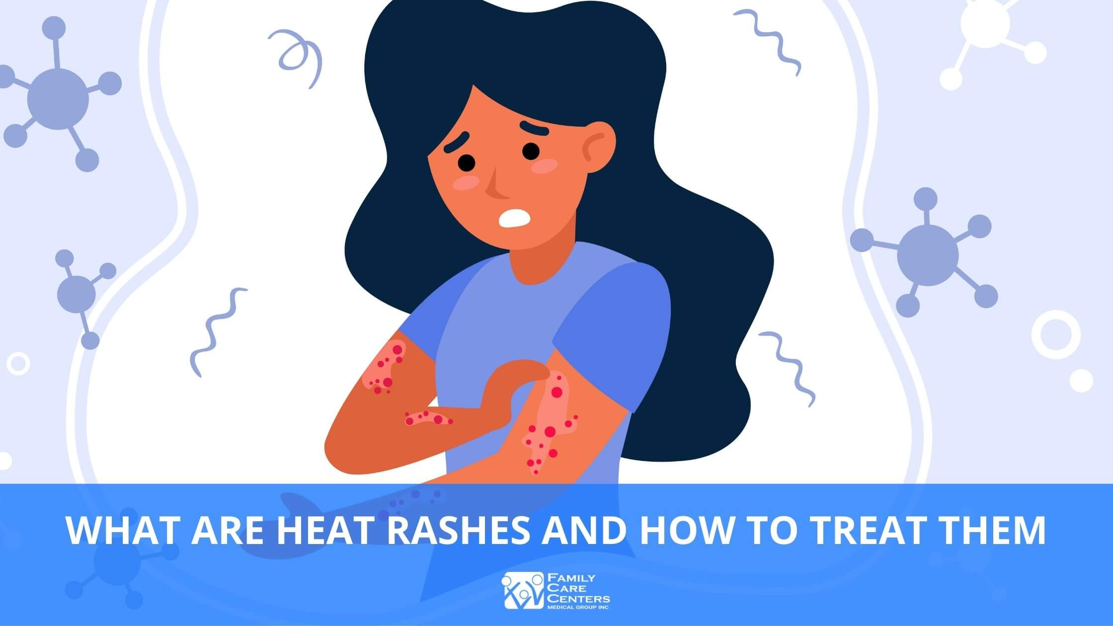 Got heat rash? Here's how to identify and treat the condition - Etre Vous