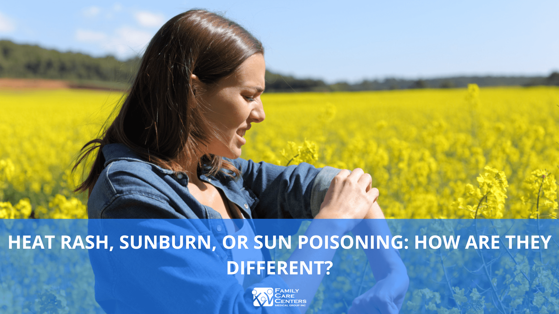 Heat Rash, Sunburn, or Sun Poisoning: How Are They Different?