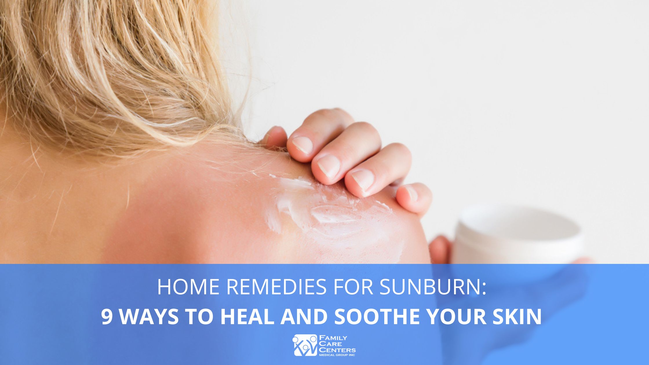 7 Natural Remedies to Soothe Sunburnt Skin