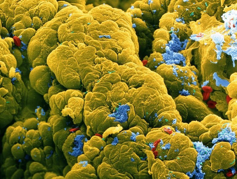 Gut Microbiomes And Cancer