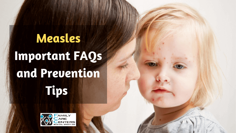 Measles: Important FAQs and Prevention Tips