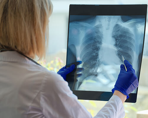 Bronchitis Treatment at Our Walk-In Clinics in Irvine, Fountain Valley, and Costa Mesa